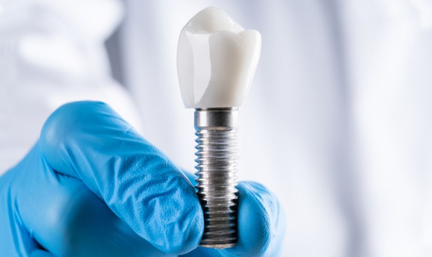 Dental implants