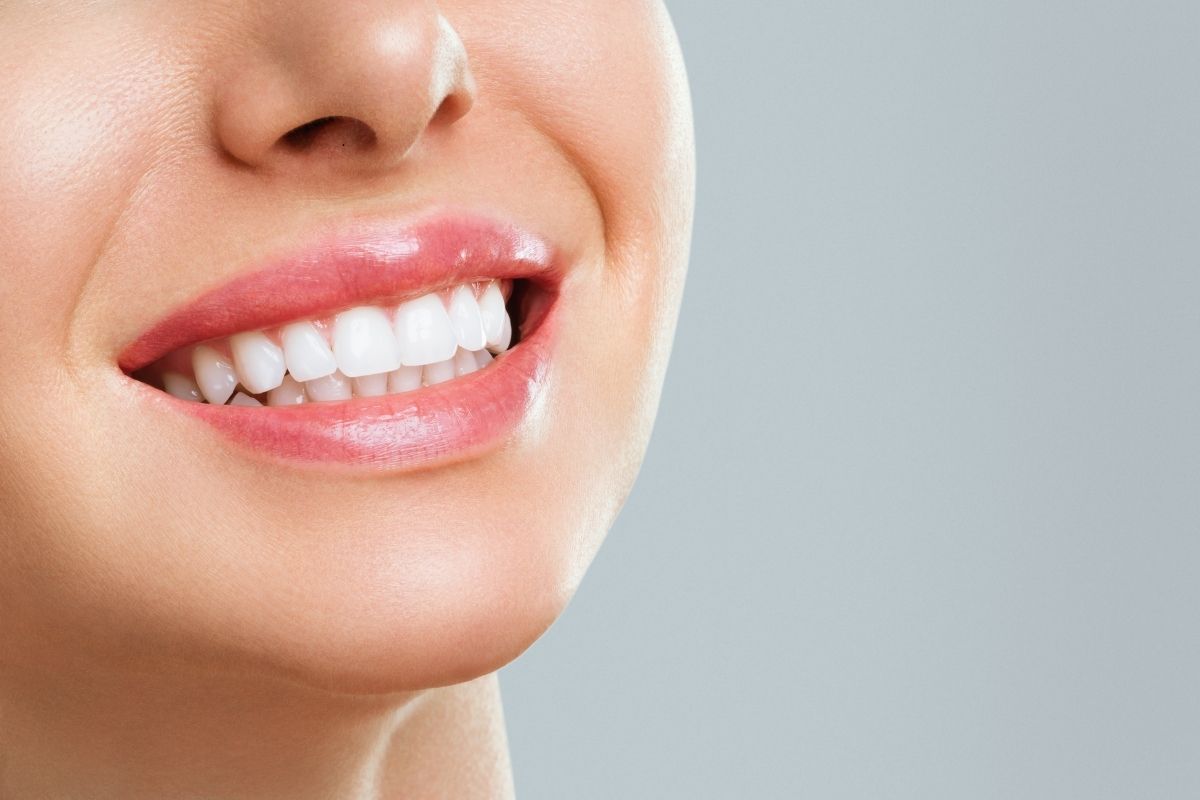 Teeth Whitening in Oceanside