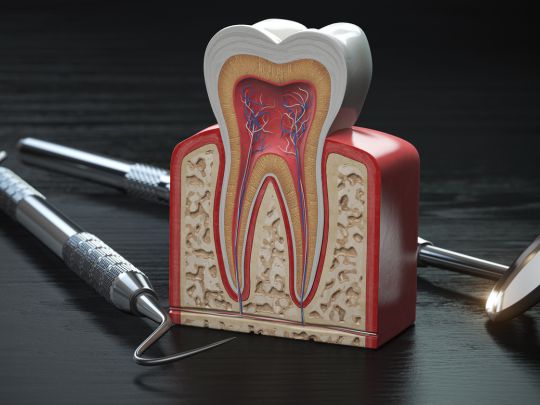 Root canal treatment in Oceanside