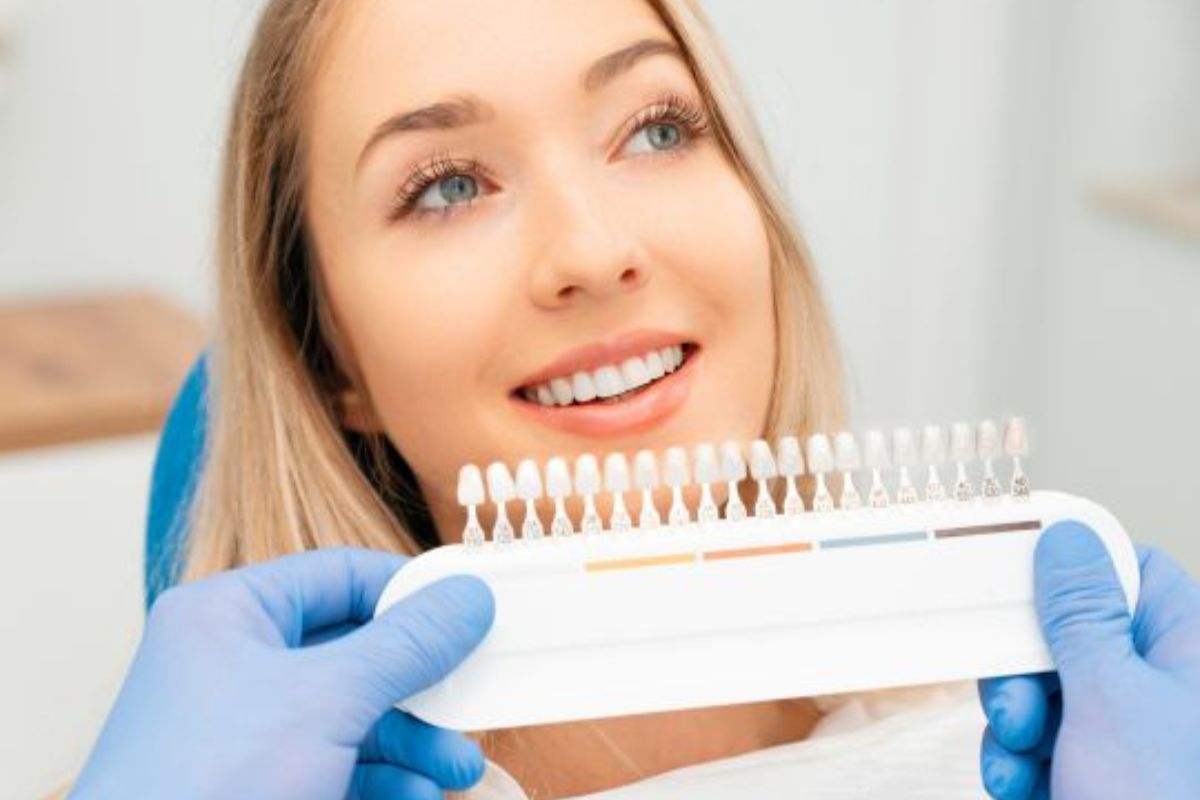 Dental veneers