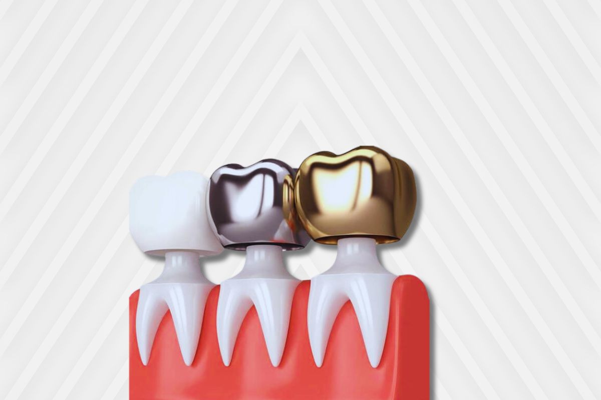 Dental Crowns for Cosmetic Enhancement