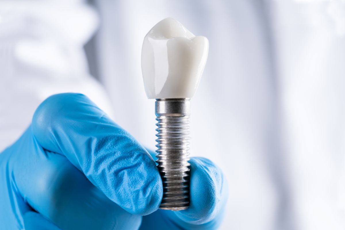 How to Maintain Your Dental Implants for a Lifetime
