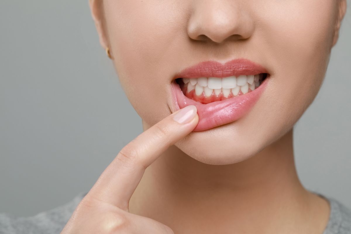 Non-Surgical vs. Surgical Treatments for Periodontitis