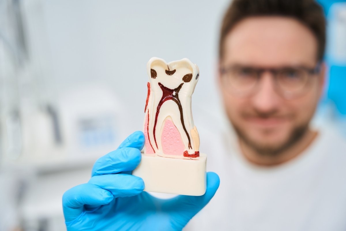 Debunking Root Canal Myths