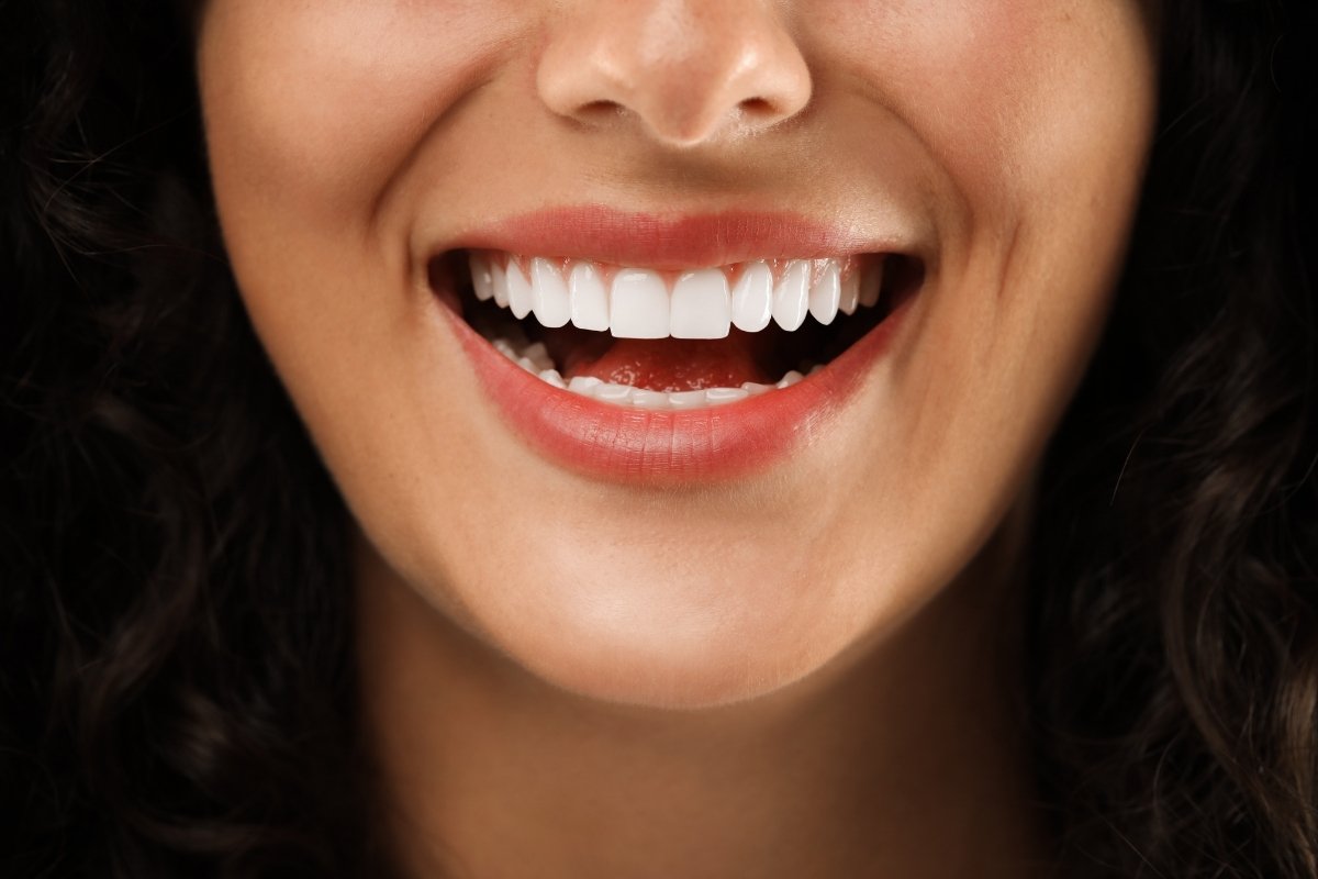 Professional Cleaning and Maintenance: Why Regular Dental Visits Matter for Veneers