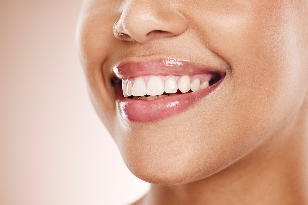 Enhancing Smiles and Confidence The Vital Role of Cosmetic Dentistry