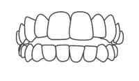 Line drawing of upper and lower teeth in proper alignment, showing dental occlusion.