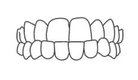Straight teeth diagram showing proper dental alignment and bite for orthodontic reference.